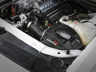aFe Momentum Carbon Fiber Cold Air Intake (w/Dual Filter Media): Dodge Challenger / Charger 6.2L (15-16)